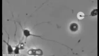 Neurogenesis (The Brain Growing)