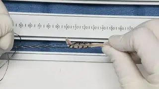 Soft-Tissue Graft Suturing With SutureTape: Technique and Pearls