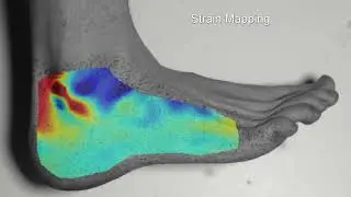 Ankle Click Strain Map