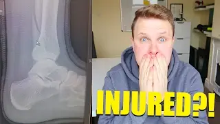 Dealing With Injury! Sport Mental Skills