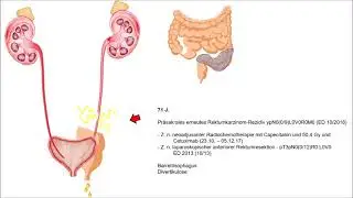Allium Stents- Therapieoptionen bei Ureterdefekten, Dr. Neymeyer