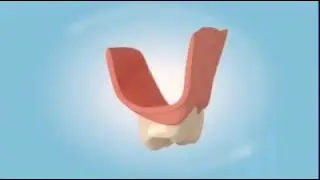 Полный съемный зубной протез
