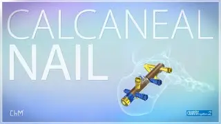 Calcaneal Nail