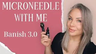 Microneedle With Me Using the Banish Kit!