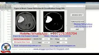 Types of Brain Tumor Classification Using CNN With Source Code Brain Tumor Segmentation