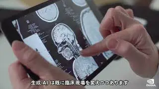 生成AIで医用画像を自在に作り出す [MONAIフレームワークのご案内]