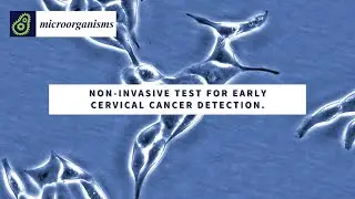 Non-invasive urine test for early cervical cancer detection🔬
