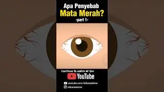Apa Penyebab Mata Merah?