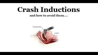 Crash Inductions