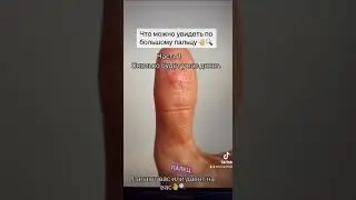 Что можно увидеть по большому пальцу 🖐🔍часть 1