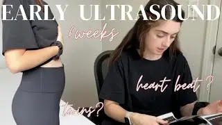 6 Weeks Ultrasound | Heart Beat?! Twin?! | #pregnancy