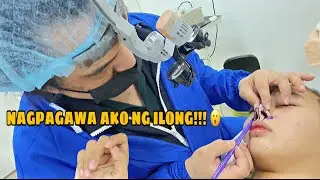 MY NOSE RHINOPLASTY JOURNEY | MASAKIT BA? 🥺 | Martinavlogs
