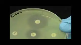 Antibiotic susceptibility