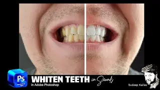How to Whiten Teeth in Photoshop