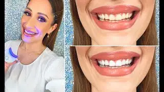 Whitening your teeth at home | Any Gonzalez