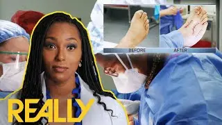 Dr Ebonie Spends 7 HOUR Surgery On A Foot With Almost All Bones Broken | My Feet Are Killing Me