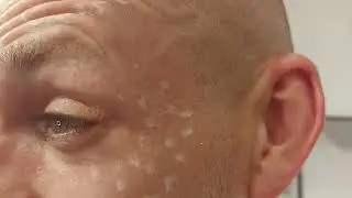 Токсин .Разметка.