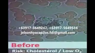 Alpha Meta, Alpha Spin, JMS3 Live Blood Analysis (+63917-5649534, +63917-5649247)