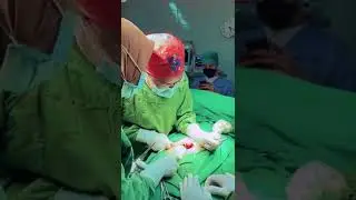 Day in the life - appendicitis perforation