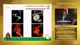 Manejo Endovascular de Lesiones Vasculares Intracraneales Complejas, Dr. Gustavo Melo Guzmán