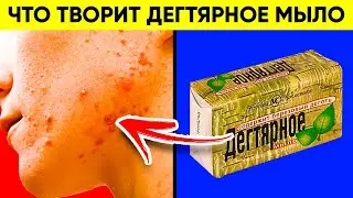 Убирает Перхоть, Акне, Грибок... Вот Что Творит Дегтярное Мыло! Польза и Вред Дегтярного Мыла!