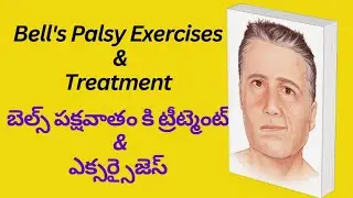 Bell's palsy Exercises & treatment