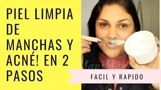 ELIMINA MANCHAS  Y ACNÉ de la PIEL CON BICARBONATO Y LIMÓN/ Facil y rapido
