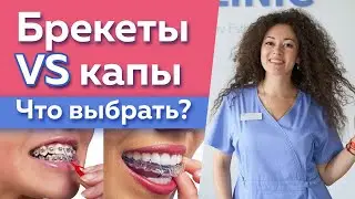 Как выровнять зубы? / Что лучше выбрать: капы или брекеты?