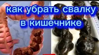 87052501890. Как избавиться от СВАЛКИ в вашем кишечнике.Врач Мигунова с 45 летним стажем.