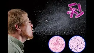 TOSSIR e ESPIRRAR realmente TRANSMITE micróbios?? - TESTEI culturas com coloração de GRAM!