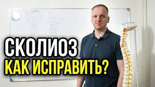 Сколиоз у детей, у подростков, у взрослых. Как лечить искривление позвоночника.