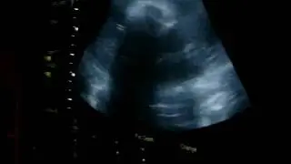 100_3440.MOV Part 2