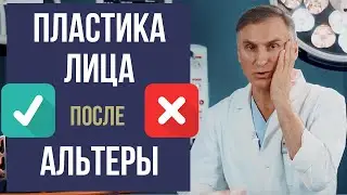 КРУГОВАЯ ПОДТЯЖКА ЛИЦА ❌ ПОСЛЕ СМАС ЛИФТИНГ АЛЬТЕРА 🔥 РЕАЛЬНО⁉️