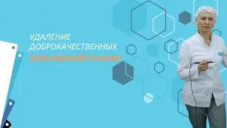Удаление доброкачественных новообразований