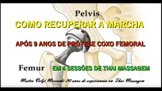 Como recuperar  o caminhar pós prótese coxo femoral#coxofemoral#prótese#vidasaudável