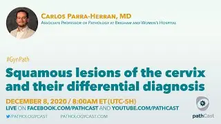 Squamous lesions of the cervix and their differential diagnosis Dr. Parra-Harran (BWH) 