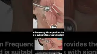 EVE Facial 13: EMS #2