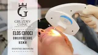 Элос   ELOS   омоложение кожи или как это работает