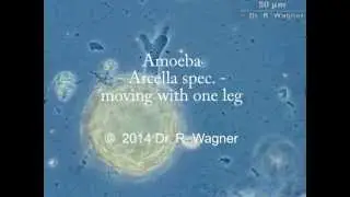 Arcella gibbosa, just another Amoeba