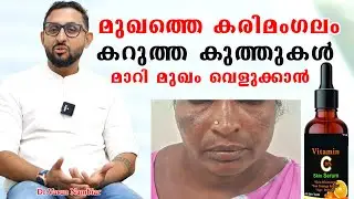 രാത്രി കിടക്കുന്നതിന് മുമ്പ് ഇത് രണ്ടുതുള്ളി മുഖത്ത് പുരട്ടി കിടന്നുറങ്ങിയാൽ /Dr Varun Nambiar