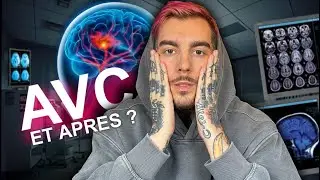 AVC ET APRÈS ? MON NOUVEAU QUOTIDIEN