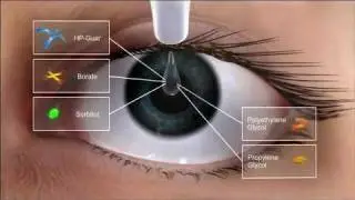 Alcon Dry Eye Video and Systane Ultra Action