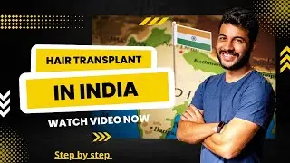 Hair Transplant Surgery in India Step by Step | Best Hair Transplant Results | Hair Transplant India