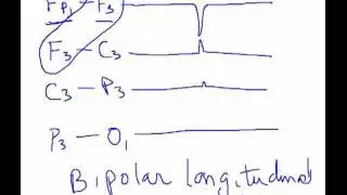 EEG - Localization