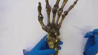 Лучезапястный сустав