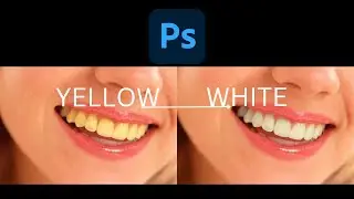 Easy Teeth Whitening in Photoshop | Photoshop Tutorials | Photoshop Hacks