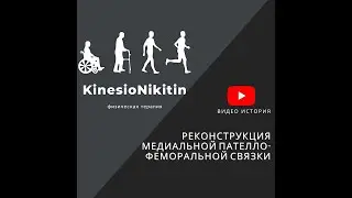 Травма колена. Реабилитация после операции на коленном суставе. МПФС MPFL