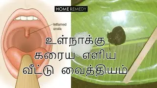 Natural Remedies For Swollen Uvula  | Continuous Cough | உள்நாக்கு கரைய எளிய வீட்டு வைத்தியம்