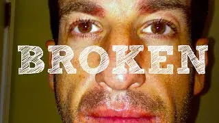 HEAL | BROKEN by Stephen Munson