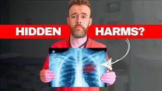 What they don't tell you about RADIATION from scans ☢️